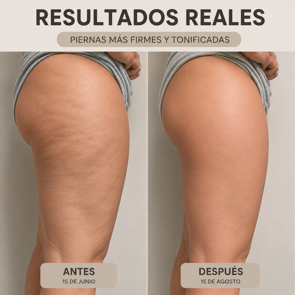 CelluPro™ | Short de Compresión Anticelulitis