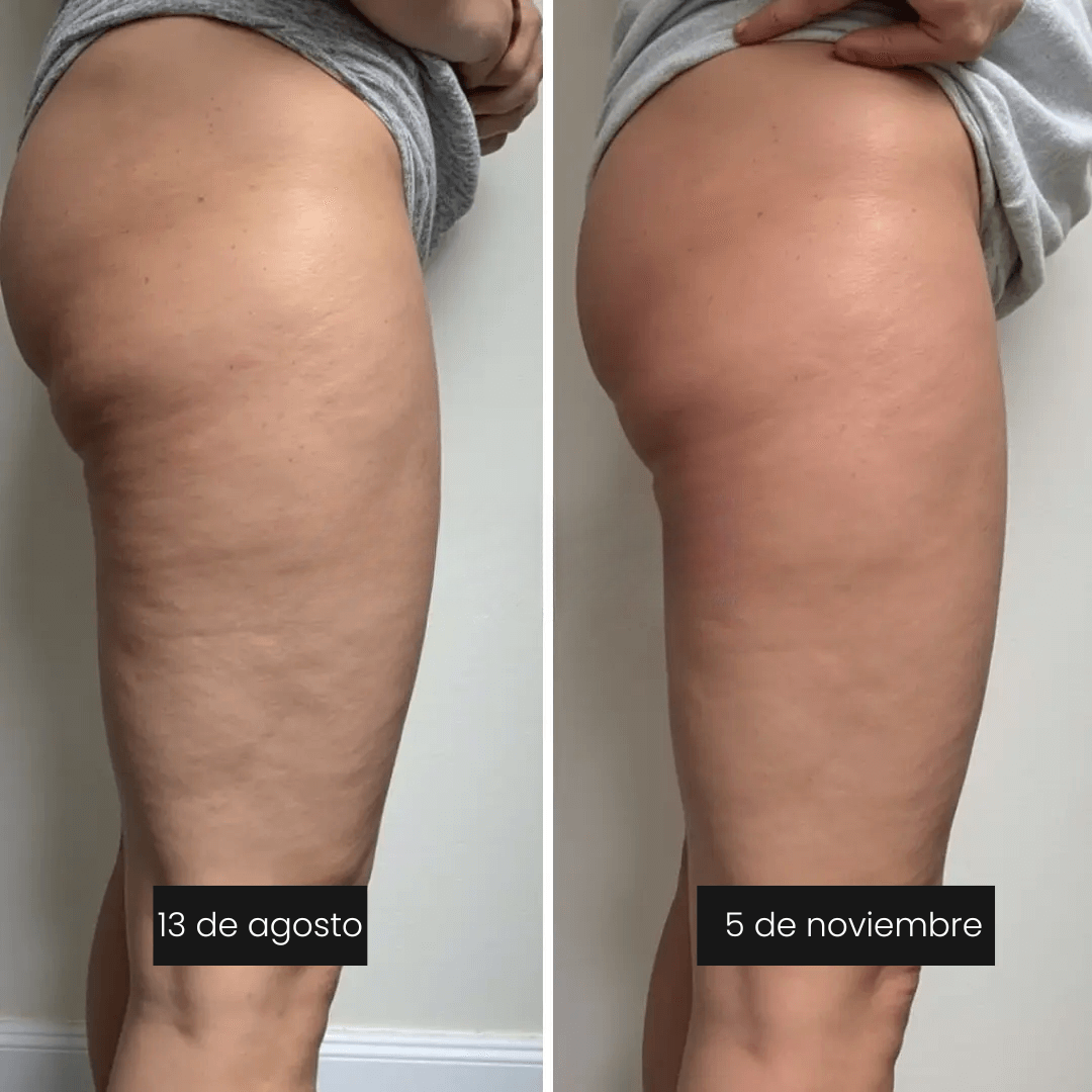 CelluPro™ – Leggings 3D Anticelulíticos y Moldeadores